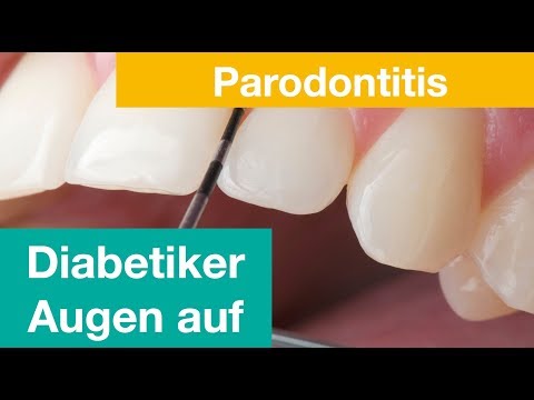 An jedem Zahn hängt ein Mensch - Zähne und Diabetes
