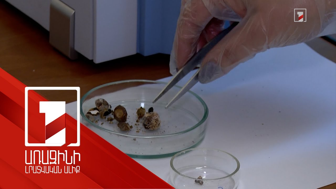 Փորձագիտական կենտրոնի նոր սարքավորման միջոցով եզակի բժշկական հետազոտություն է իրականացվում