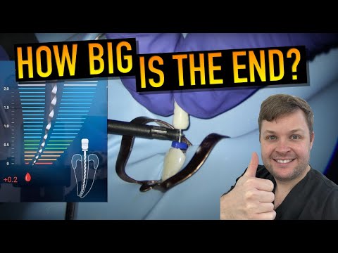 📌 Master Apical Gauging for Wide Canals!