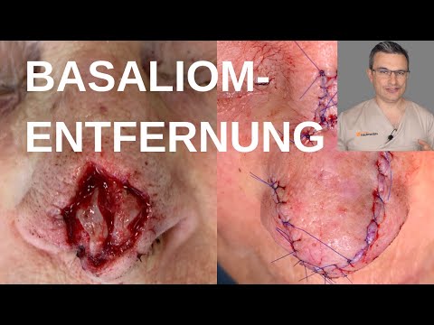 Dr. med. Kasten Dermatologische Privatpraxis