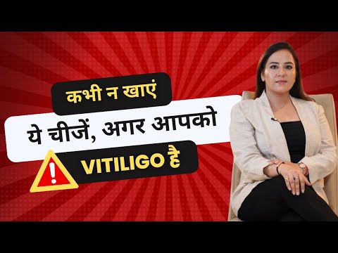 NEVER EAT THESE FOODS | Vitiligo Special | Dr. Nitika Kohli