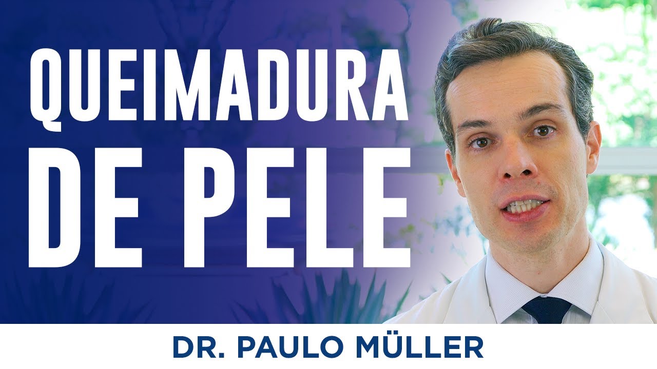 Queimaduras de Pele - Primeiros Socorros – Dr. Paulo Müller Dermatologista.