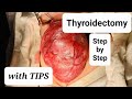 Thyroidectomy Step By Step With Tips HD 1080P Dr Tayyab Riaz Ch