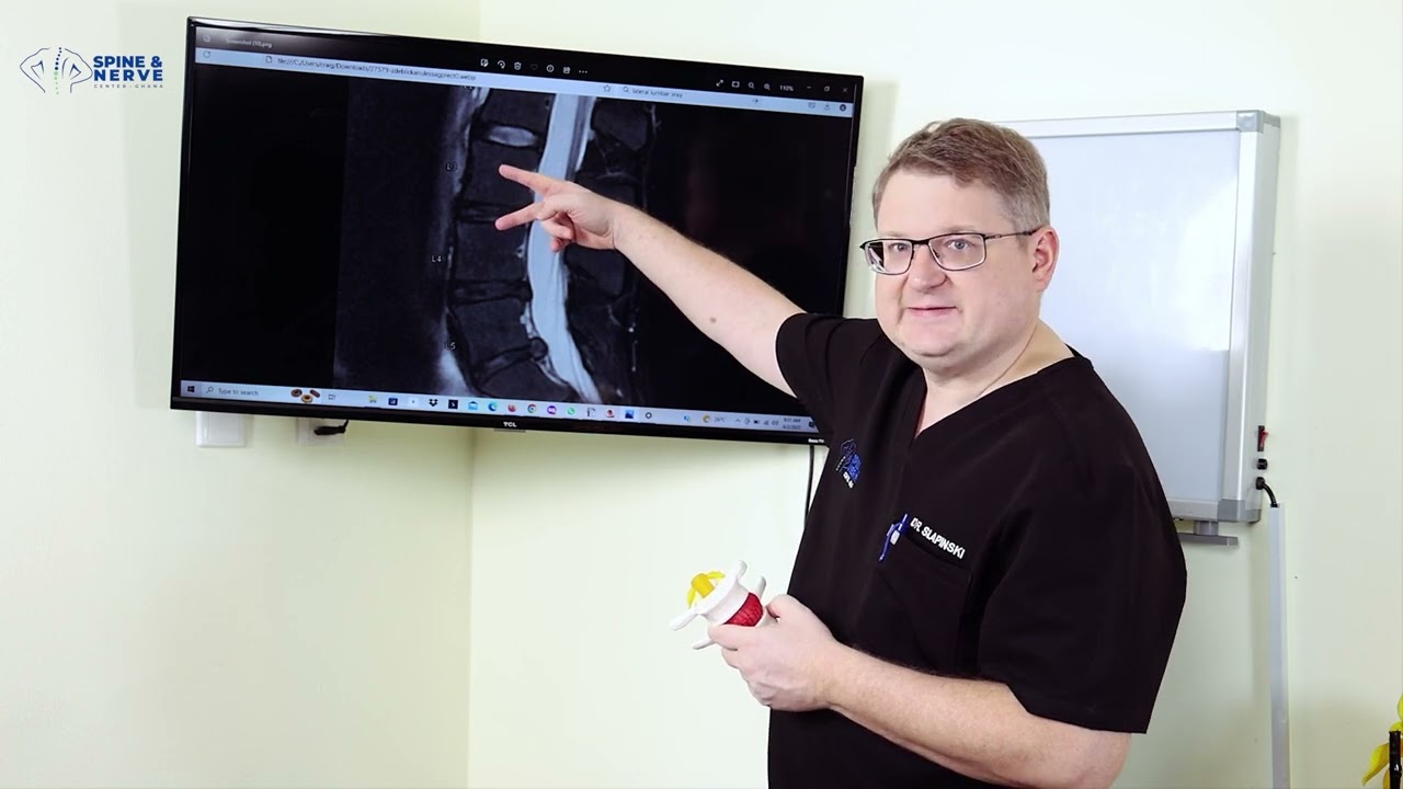 What is degenerative disc disease