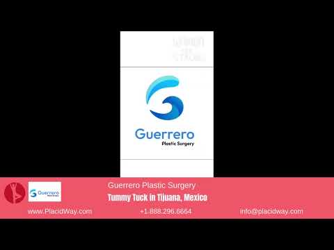Saying Goodbye to Loose Skin: Honest Testimonial of Tummy Tuck at Guerrero Plastic Surgery in Tijuana, Mexico