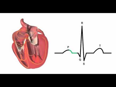 can low blood pressure trigger pvcs