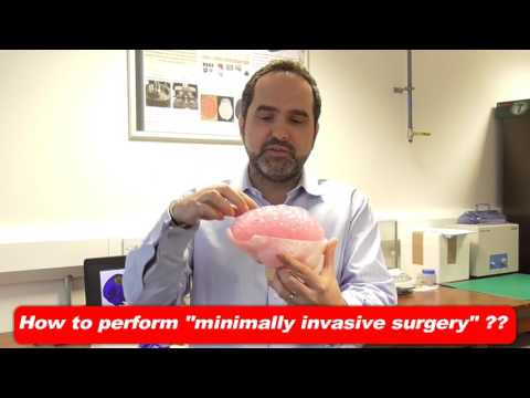 How to perform "minimally invasive surgery"?