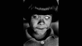 In Camera-On The Retina (live)