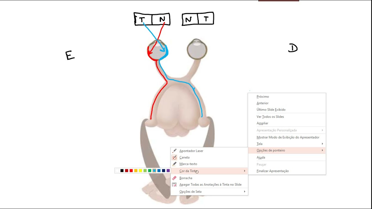 Lesões em via óptica