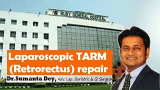 Laparoscopic TransAbdominal RetroMuscular (TARM) repair for Umbilical Hernia by Dr. Sumanta Dey