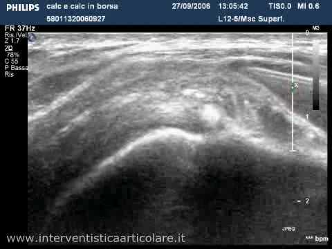 Esercizi per lanca per gli uomini Ritardare mal di stomaco, come prima delle mestruazioni e inferiore della schiena tira