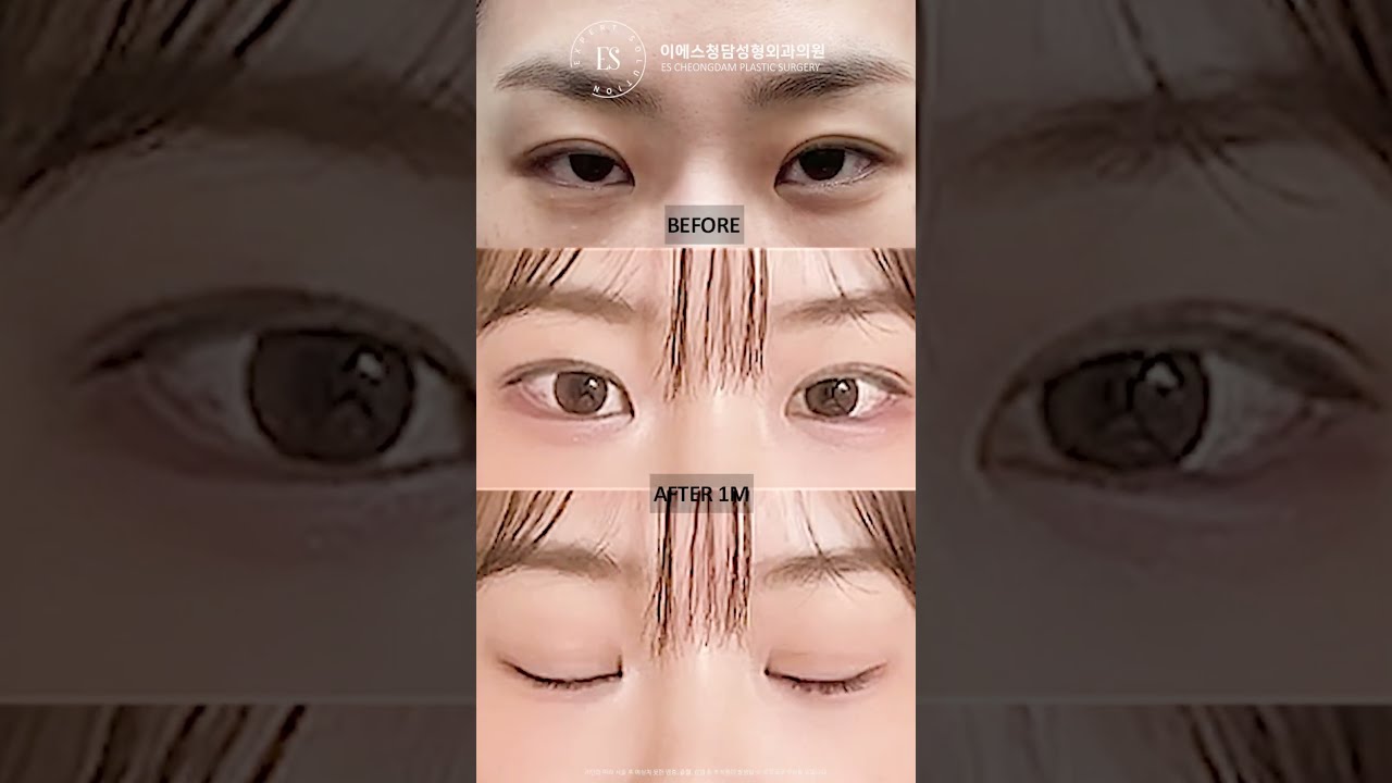 이에스 유튜브