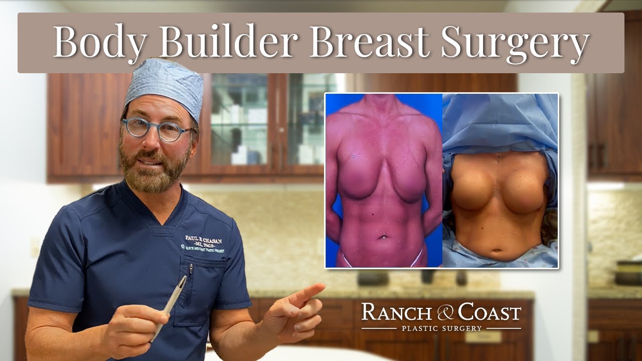 Fixing A Body Builder’s Implants?!