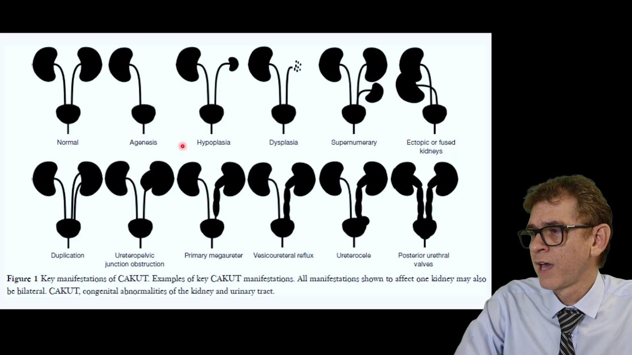 Aula - Avaliação do Sistema Urinário Fetal em 4 ETAPAS