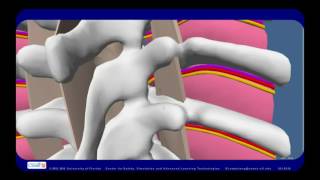 Anatomic Boundaries of the Thoracic Paravertebral Space