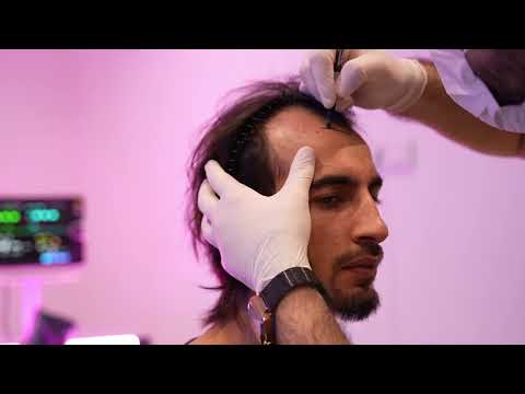 Témoignage patient — vidéo 1