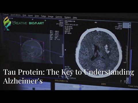 Tau Protein: The Key to Understanding Alzheimer's