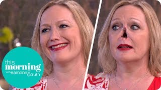 I Lost My Nose to an Autoimmune Disease and Now My New One Is Held on With Magnets | This Morning