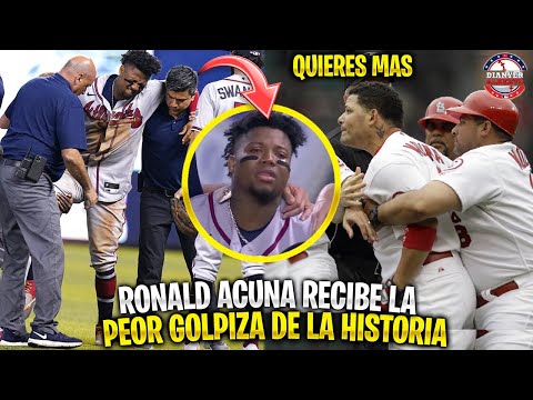 The time Ronald Acuña Jr. took the worst beating in history | MLB