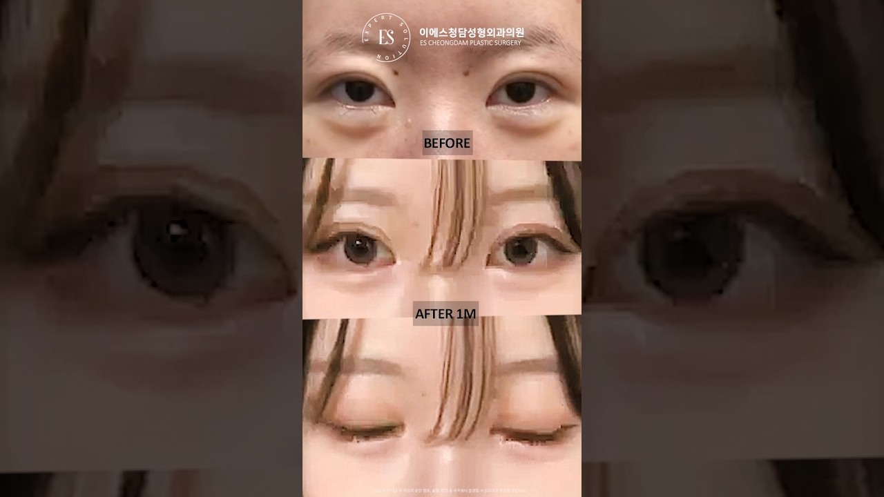 이에스 유튜브