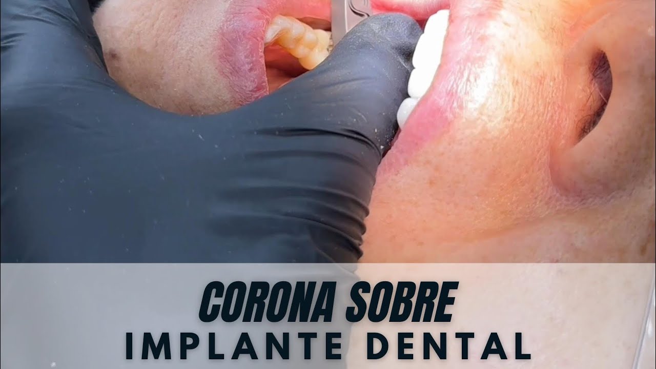 Johanna Andrea Calderón Bohorquez-21