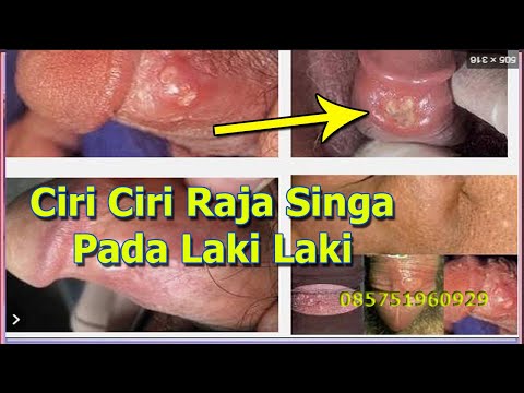 Dapat ditingkatkan potensi Dimana untuk membeli wanita patogen Orenburg