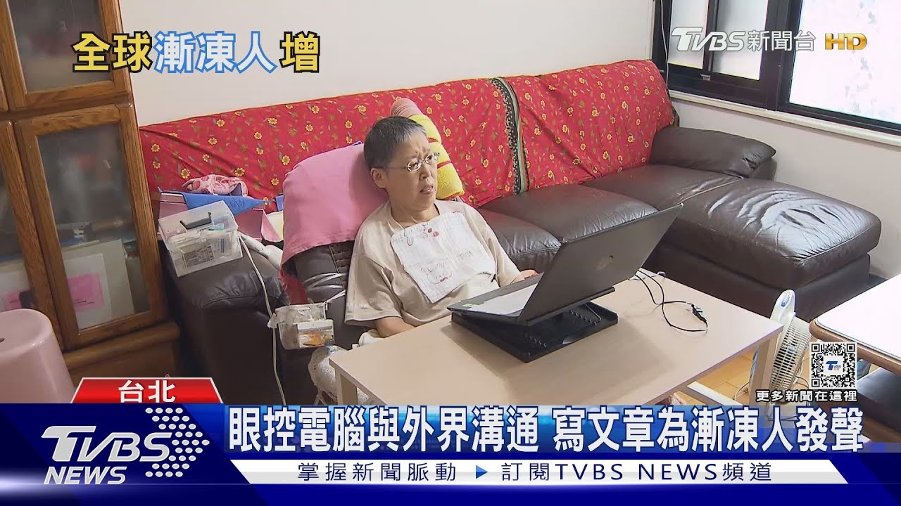 全球漸凍人將增近7成於2040年 壽命延長神經退化性疾病發生率增加