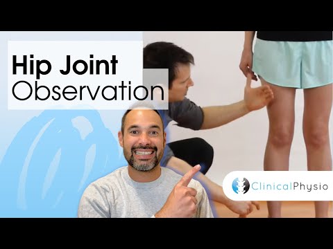 Hip Joint Observation | Clinical Physio
