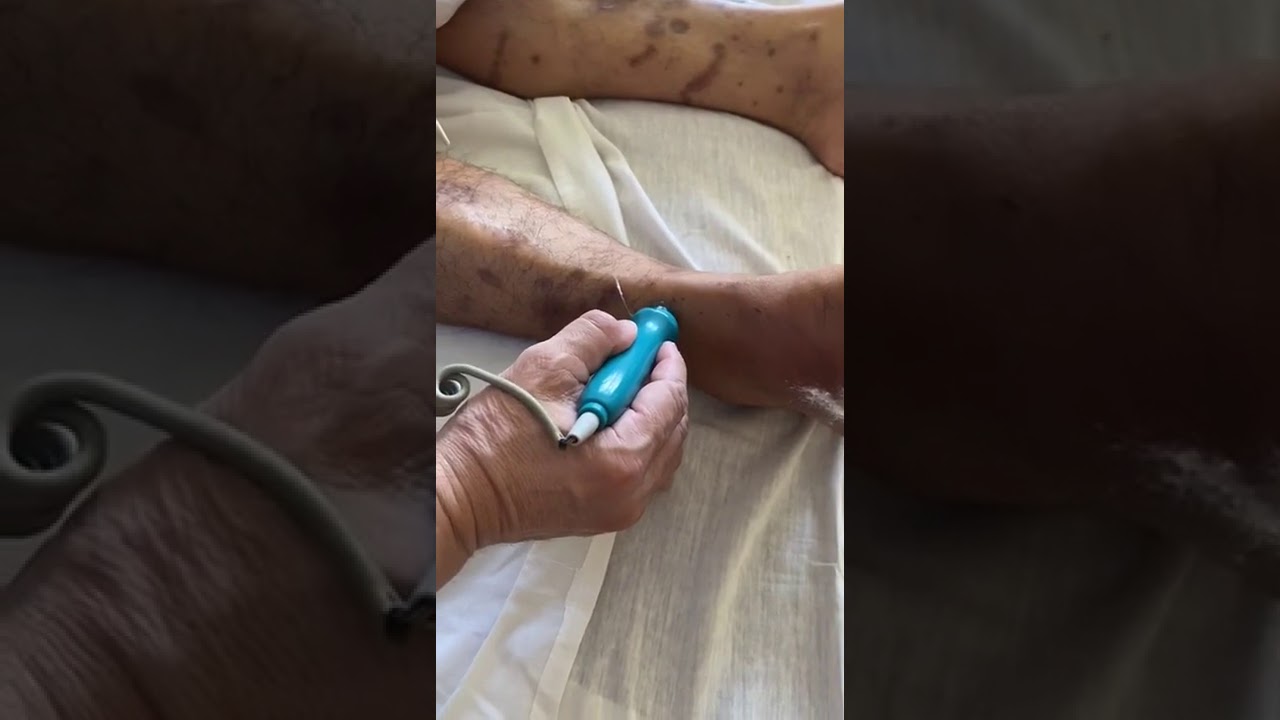 Juan De Dios Candia Camacho-30