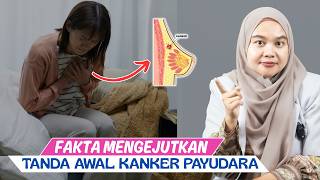 Download lagu DON'T IGNORE IT, THESE ARE THE EARLY SYMPTOMS OF BREAST CANCER THAT YOU MUST WATCH OUT FOR - DOCT... mp3 Download lagu DON'T IGNORE IT, THESE ARE THE EARLY SYMPTOMS OF BREAST CANCER THAT YOU MUST WATCH OUT FOR - DOCT... mp3