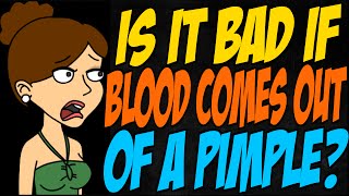 Is it Bad if Blood Comes Out of a Pimple?