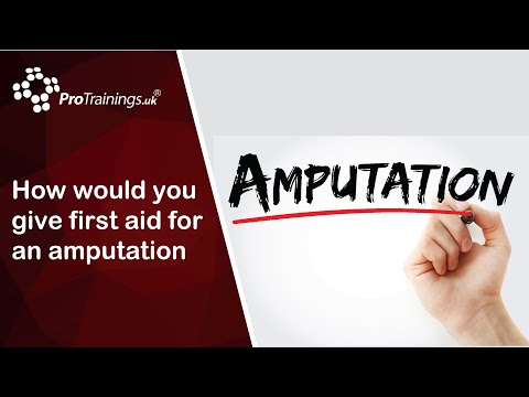 How would you give first aid for an amputation