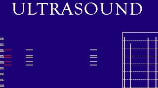 &quot;The Last Days of Summer&quot; piano midi - Ultrasound