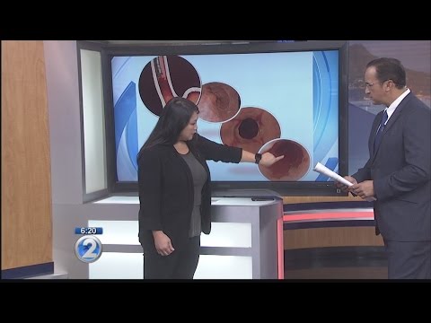 Ask a Specialist: Barrett’s Esophagus