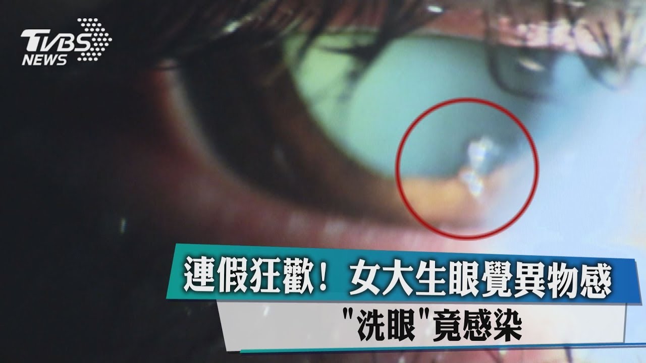 連假狂歡!女大生眼覺異物感 洗眼竟感染