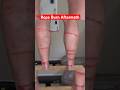 Aftermath of SEVERE Rope Burns… #funny #comedy #science