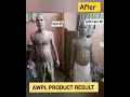 AWPL Product Result In Psoriasis Asclepius Wellness Product Awpl Healthandwellness