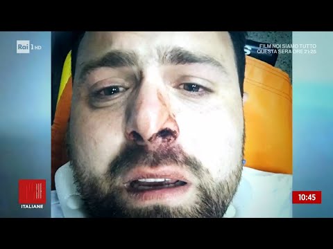 Botte dal branco dell'isola: "sono vivo per miracolo!" - Storie italiane 11/05/2022