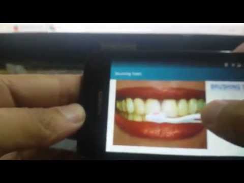Brushing Teeth Simulation