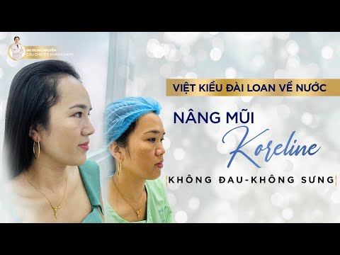 Việt Kiều Đài Loan chia sẻ trải nghiệm nâng mũi tại Dr Trung Nguyễn