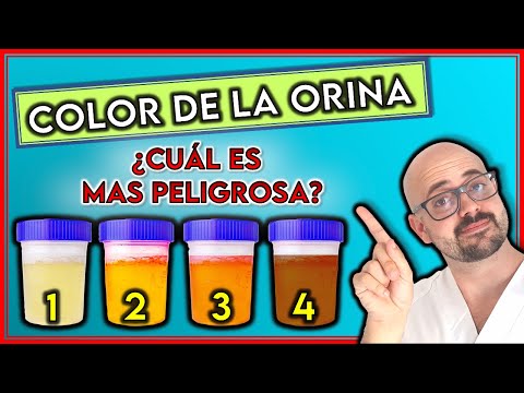 El Color De Tu Orina Puede Revelar Mucho Sobre Tu Estado De Salud