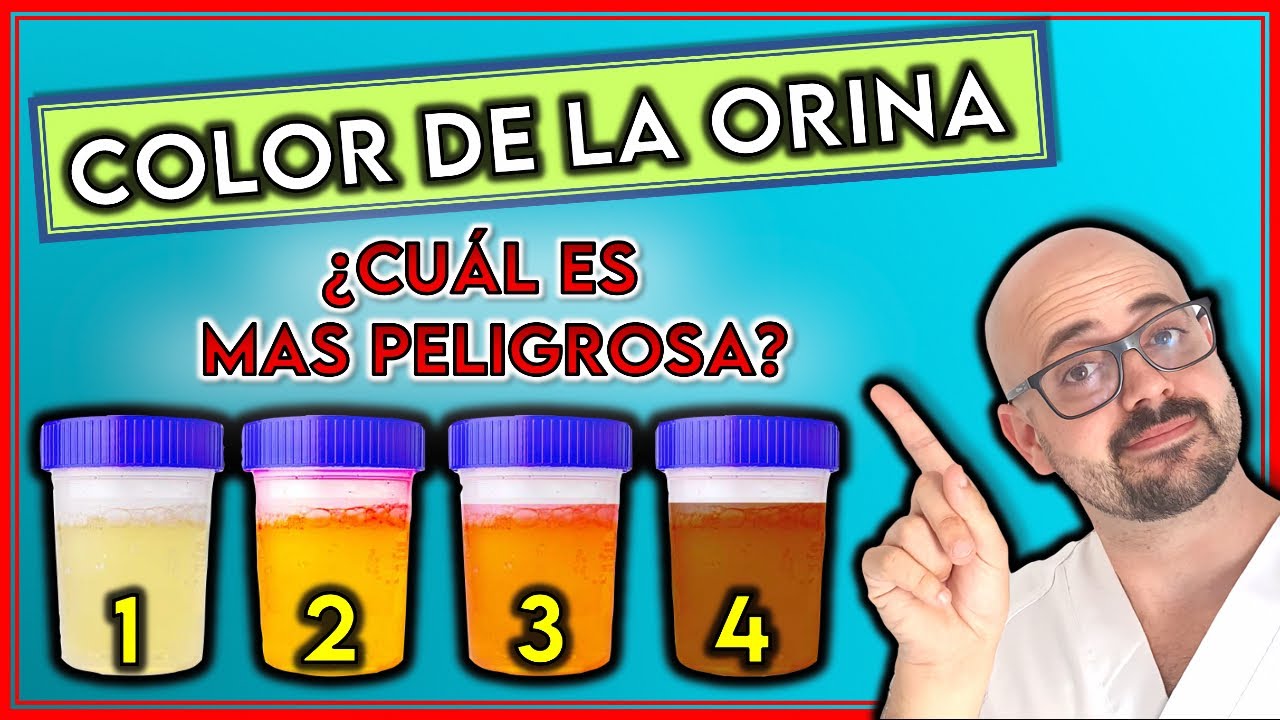 ¿Qué SIGNIFICA el COLOR de tu ORINA? || ¿Cuál INDICA enfermedad GRAVE?