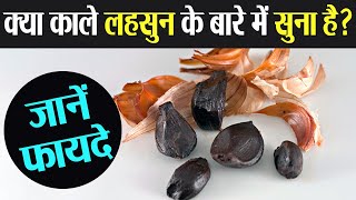 काला लहसुन किसी सुपरफूड से कम नहीं, जानें फायदे | Black Garlic Healthy Benefits in Hindi | Boldsky