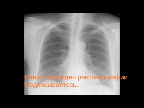 Где записался на эндопротезирование коленного сустава Что делать болит ноющими болями поясница