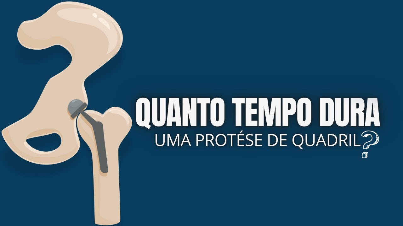 QUANTO TEMPO DURA UMA PRÓTESE DE QUDRIL?