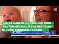 Dad In Tears After Son With Down Syndrome Named New Gerber Baby