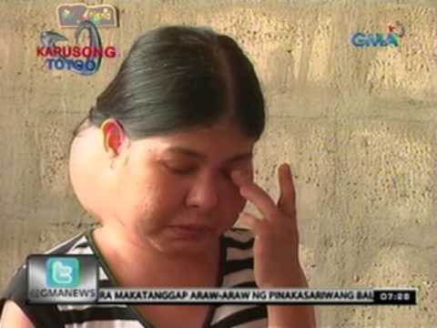 Nabawasan ako ng timbang sa pamamagitan ng 30 kg bawat araw Tao na paraan ng getting alisan ng cellulite