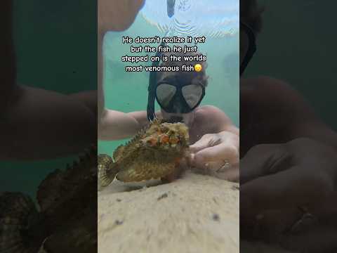 HE STEPPED ON A STONE FISH!#shorts