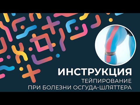 Дисплазия тазобедренных суставов мануальная терапия Чем мазать руки если болят суставы