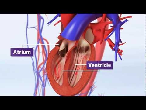 Atrial Fibrillation Animation Explained: AFib & Risk of Stroke